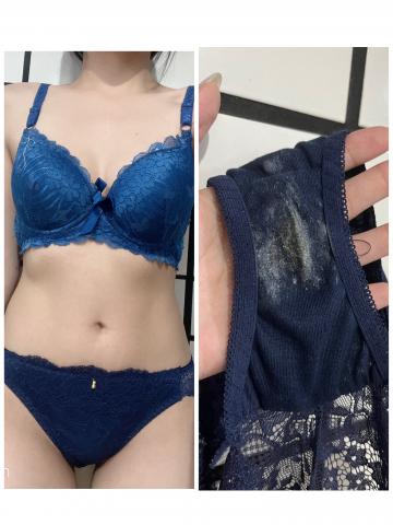 シミのところ舐めてくれる人いませんか？